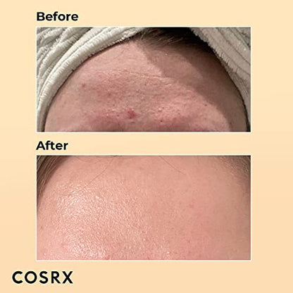 COSRX Snail Mucin 96% Power Repairing, Hydrating Serum with Snail Secretion, Korean Skincare