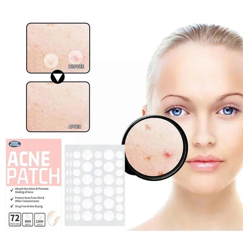 Invisible Hydrocolloid Acne Patches-Fast Healing Pimple Stickers