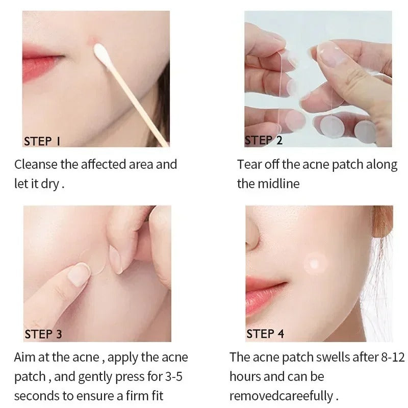 Invisible Hydrocolloid Acne Patches-Fast Healing Pimple Stickers