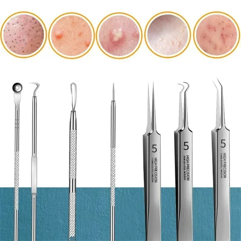 11-Piece Professional Blackhead & Pimple Extractor kit